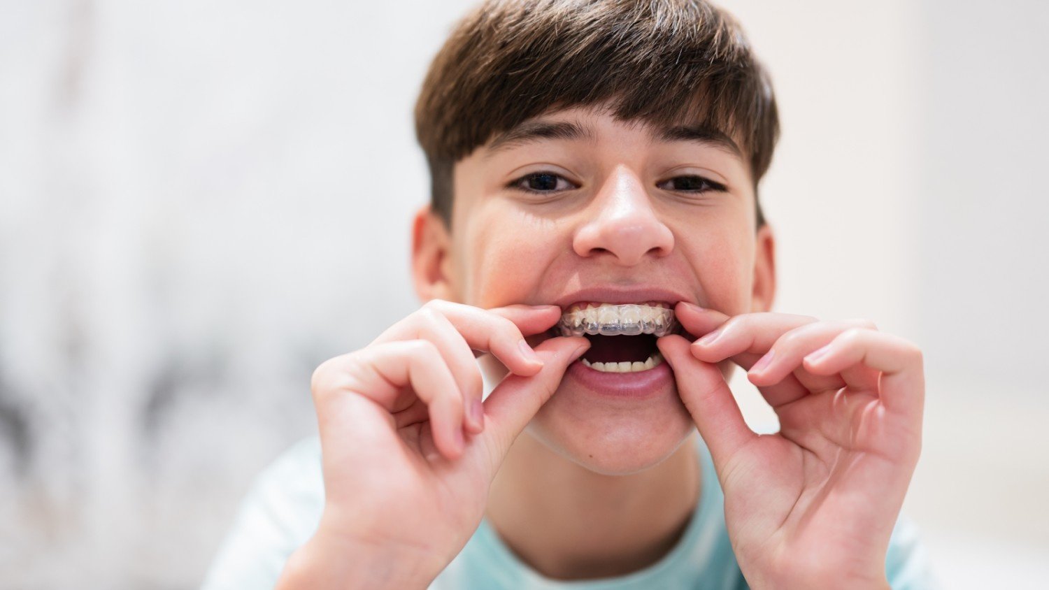 Are braces faster than Invisalign
