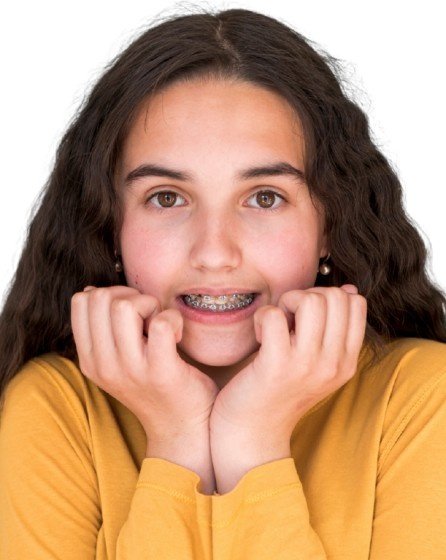 Braces vs Invisalign: Cost, Comfort, and Results Compared