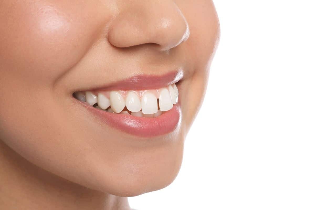 What Is Teeth Protrusion? Signs, Risks, and When to See a Dentist