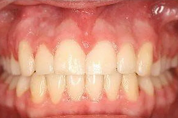 Case 4 result