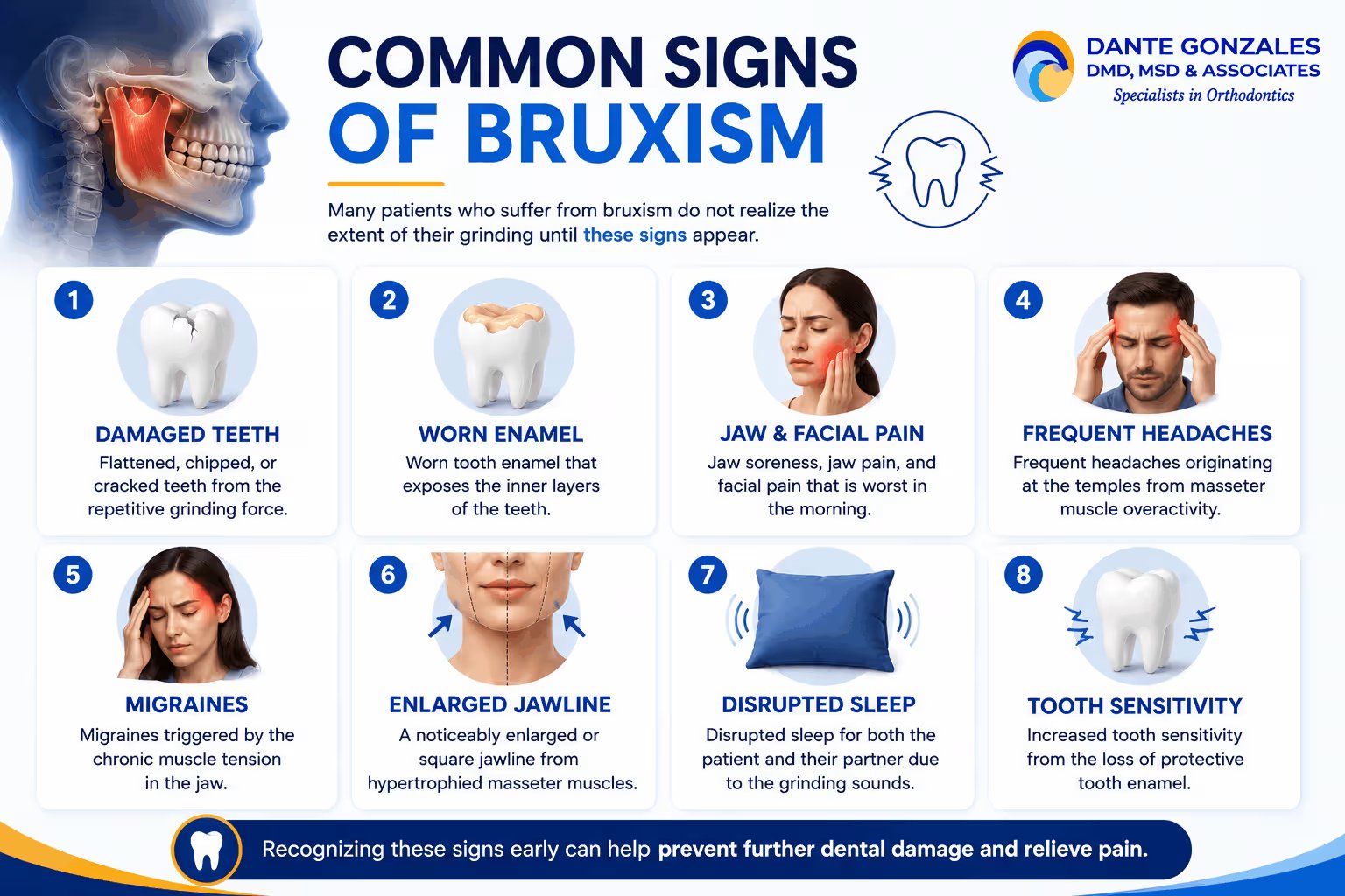 Common Signs of Bruxism