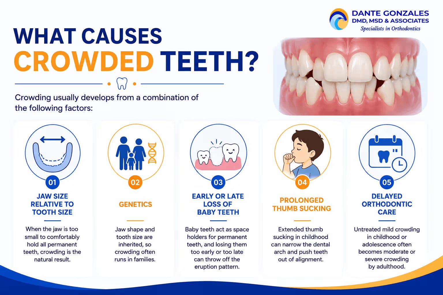 What Causes Crowded Teeth?