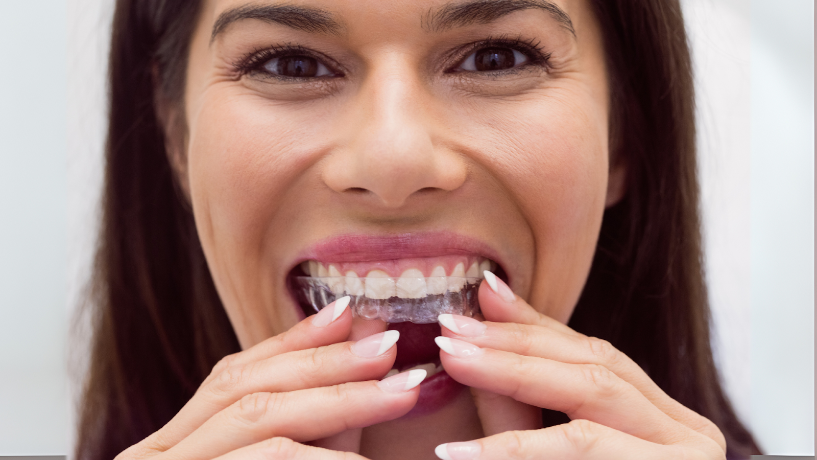 Are braces faster than Invisalign