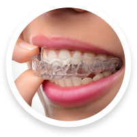 Invisalign for Adults: Benefits, Cost, and What to Expect