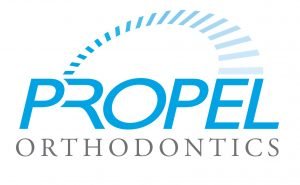 Propel accelerated orthodontics treatment