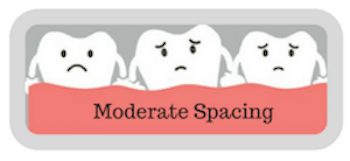 Illustration representing moderate spacing