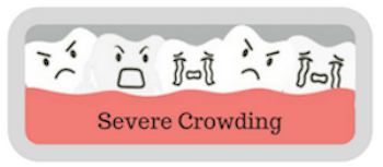 Illustration representing severe crowding
