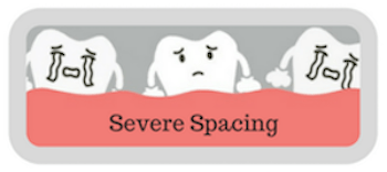 Illustration representing severe spacing
